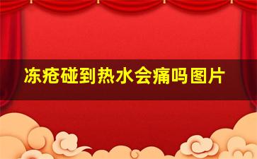 冻疮碰到热水会痛吗图片