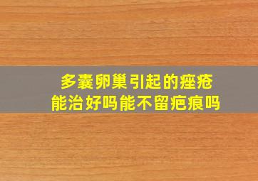 多囊卵巢引起的痤疮能治好吗能不留疤痕吗