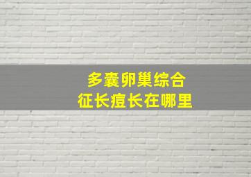 多囊卵巢综合征长痘长在哪里