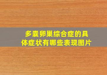 多囊卵巢综合症的具体症状有哪些表现图片