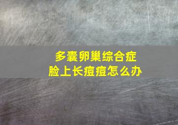 多囊卵巢综合症脸上长痘痘怎么办