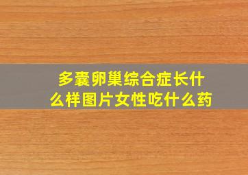 多囊卵巢综合症长什么样图片女性吃什么药