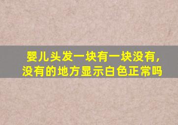 婴儿头发一块有一块没有,没有的地方显示白色正常吗