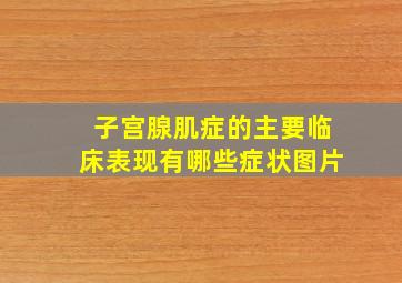 子宫腺肌症的主要临床表现有哪些症状图片