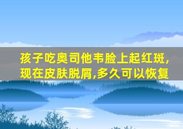 孩子吃奥司他韦脸上起红斑,现在皮肤脱屑,多久可以恢复