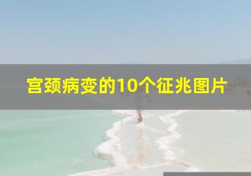 宫颈病变的10个征兆图片