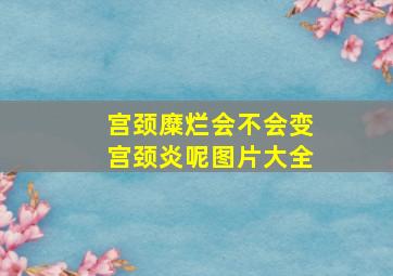 宫颈糜烂会不会变宫颈炎呢图片大全