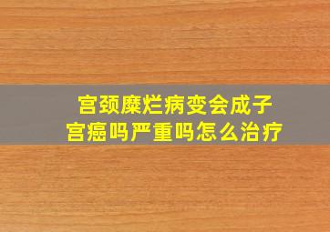 宫颈糜烂病变会成子宫癌吗严重吗怎么治疗