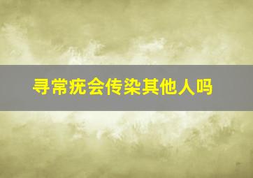 寻常疣会传染其他人吗