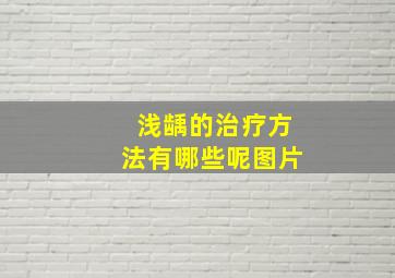 浅龋的治疗方法有哪些呢图片