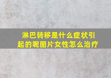 淋巴转移是什么症状引起的呢图片女性怎么治疗