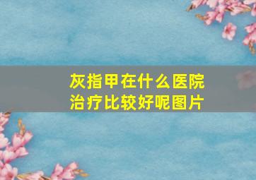 灰指甲在什么医院治疗比较好呢图片