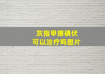 灰指甲擦碘伏可以治疗吗图片