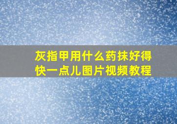 灰指甲用什么药抹好得快一点儿图片视频教程