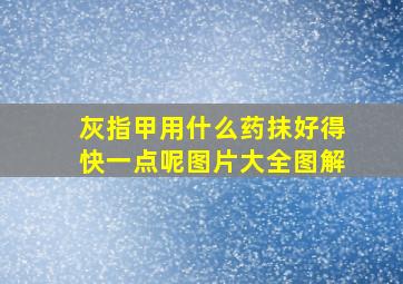 灰指甲用什么药抹好得快一点呢图片大全图解