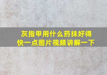 灰指甲用什么药抹好得快一点图片视频讲解一下