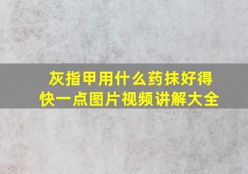 灰指甲用什么药抹好得快一点图片视频讲解大全