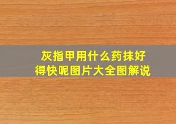 灰指甲用什么药抹好得快呢图片大全图解说