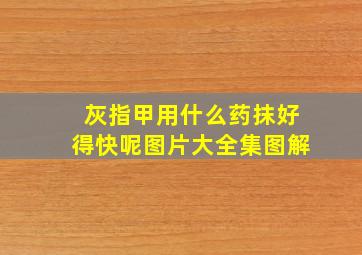 灰指甲用什么药抹好得快呢图片大全集图解