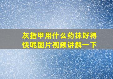 灰指甲用什么药抹好得快呢图片视频讲解一下