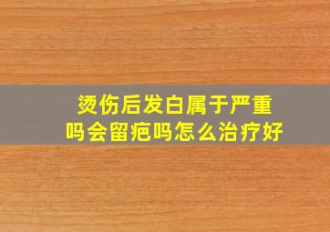 烫伤后发白属于严重吗会留疤吗怎么治疗好