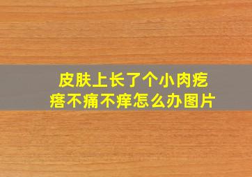 皮肤上长了个小肉疙瘩不痛不痒怎么办图片