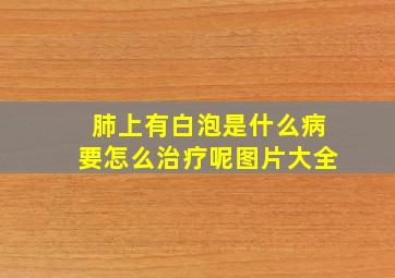 肺上有白泡是什么病要怎么治疗呢图片大全