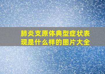 肺炎支原体典型症状表现是什么样的图片大全