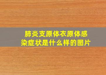 肺炎支原体衣原体感染症状是什么样的图片