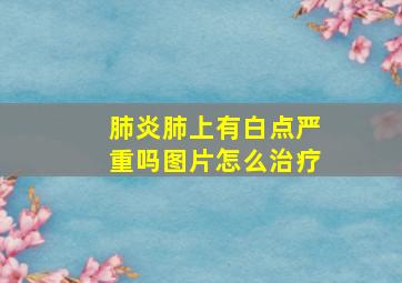 肺炎肺上有白点严重吗图片怎么治疗