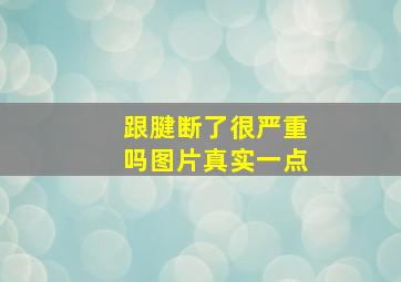 跟腱断了很严重吗图片真实一点