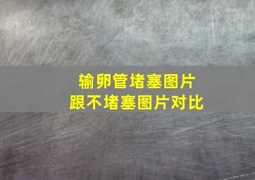 输卵管堵塞图片跟不堵塞图片对比