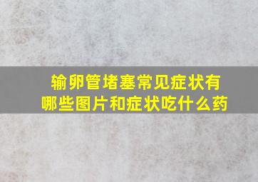 输卵管堵塞常见症状有哪些图片和症状吃什么药