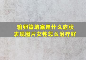 输卵管堵塞是什么症状表现图片女性怎么治疗好