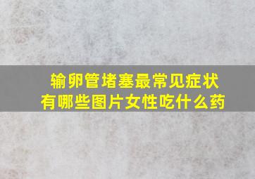 输卵管堵塞最常见症状有哪些图片女性吃什么药