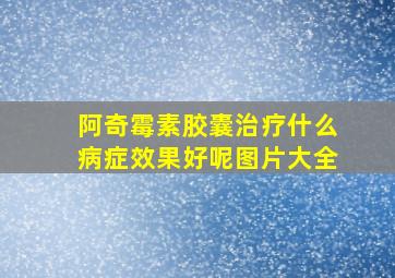 阿奇霉素胶囊治疗什么病症效果好呢图片大全