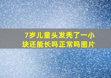 7岁儿童头发秃了一小块还能长吗正常吗图片