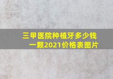 三甲医院种植牙多少钱一颗2021价格表图片