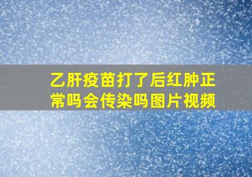 乙肝疫苗打了后红肿正常吗会传染吗图片视频