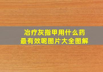 冶疗灰指甲用什么药最有效呢图片大全图解