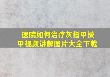 医院如何治疗灰指甲拔甲视频讲解图片大全下载