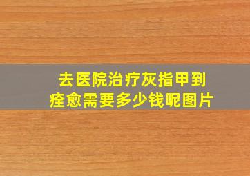 去医院治疗灰指甲到痊愈需要多少钱呢图片