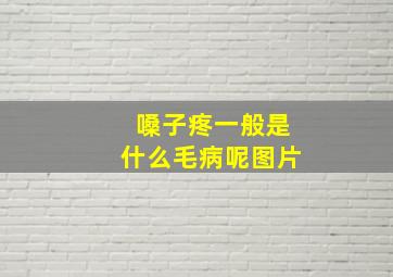 嗓子疼一般是什么毛病呢图片