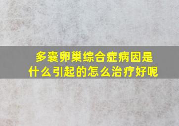 多囊卵巢综合症病因是什么引起的怎么治疗好呢