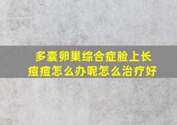 多囊卵巢综合症脸上长痘痘怎么办呢怎么治疗好