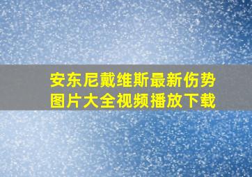 安东尼戴维斯最新伤势图片大全视频播放下载