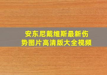 安东尼戴维斯最新伤势图片高清版大全视频