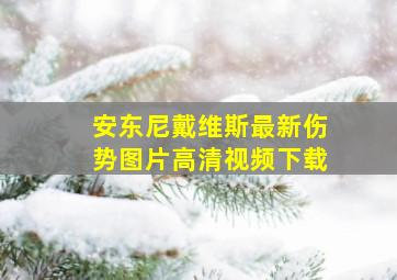 安东尼戴维斯最新伤势图片高清视频下载