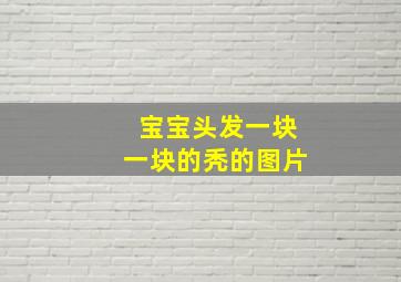 宝宝头发一块一块的秃的图片