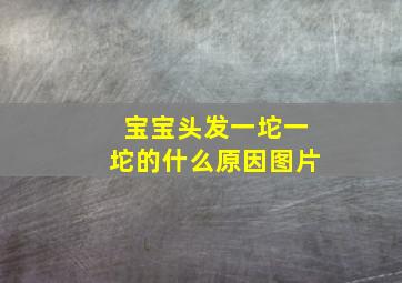 宝宝头发一坨一坨的什么原因图片